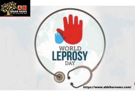  World Leprosy Day: जानिये इससे बचने के क्या – क्या हैं उपाय